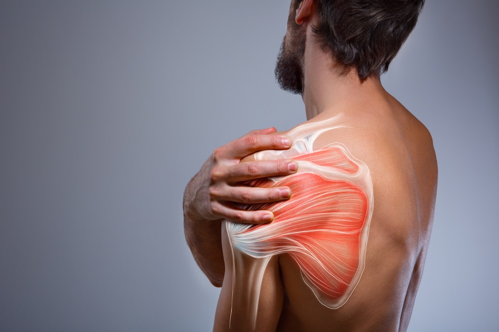 What is Shoulder Impingement? How Physiotherapy Can Help